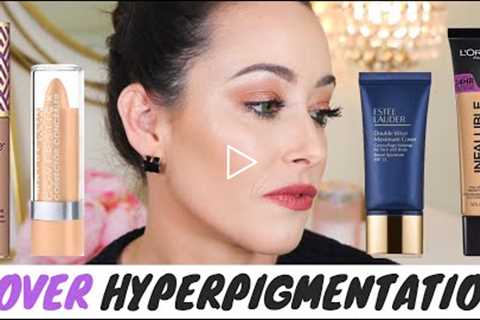 THE BEST MAKEUP TO COVER HYPERPIGMENTATION, MELASMA, DARK SPOTS & SKIN IMPERFECTIONS