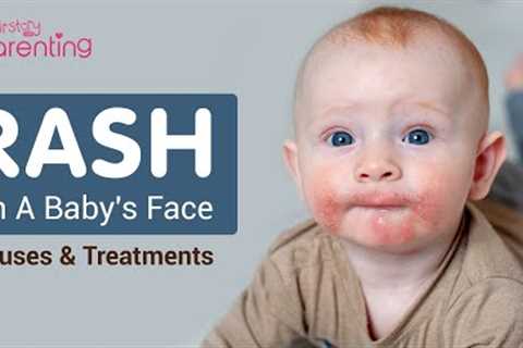 Rash On Baby's Face -  Reasons and Remedies